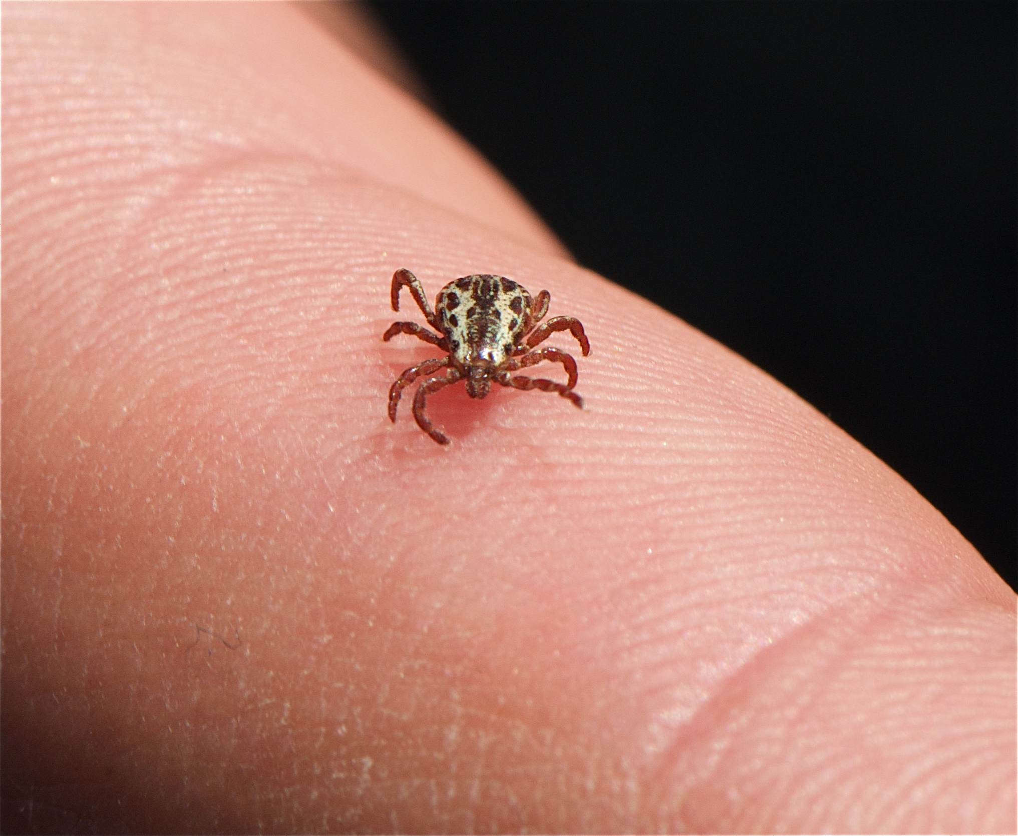 Sesame-seed-shaped, brown dog tick walks on a person’s finger